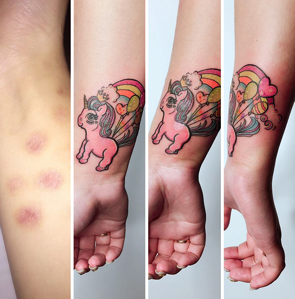 Татуировки на шрамах на руке. Татуировки, перекрывающие шрамы