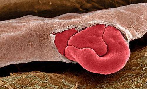 оболочки артерий мышечного типа