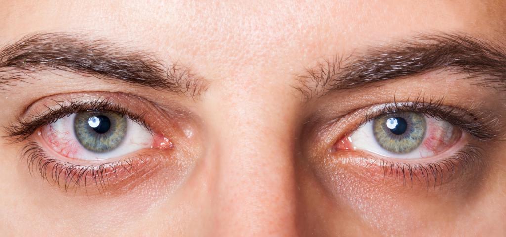 стафилококк в глазах лечение
