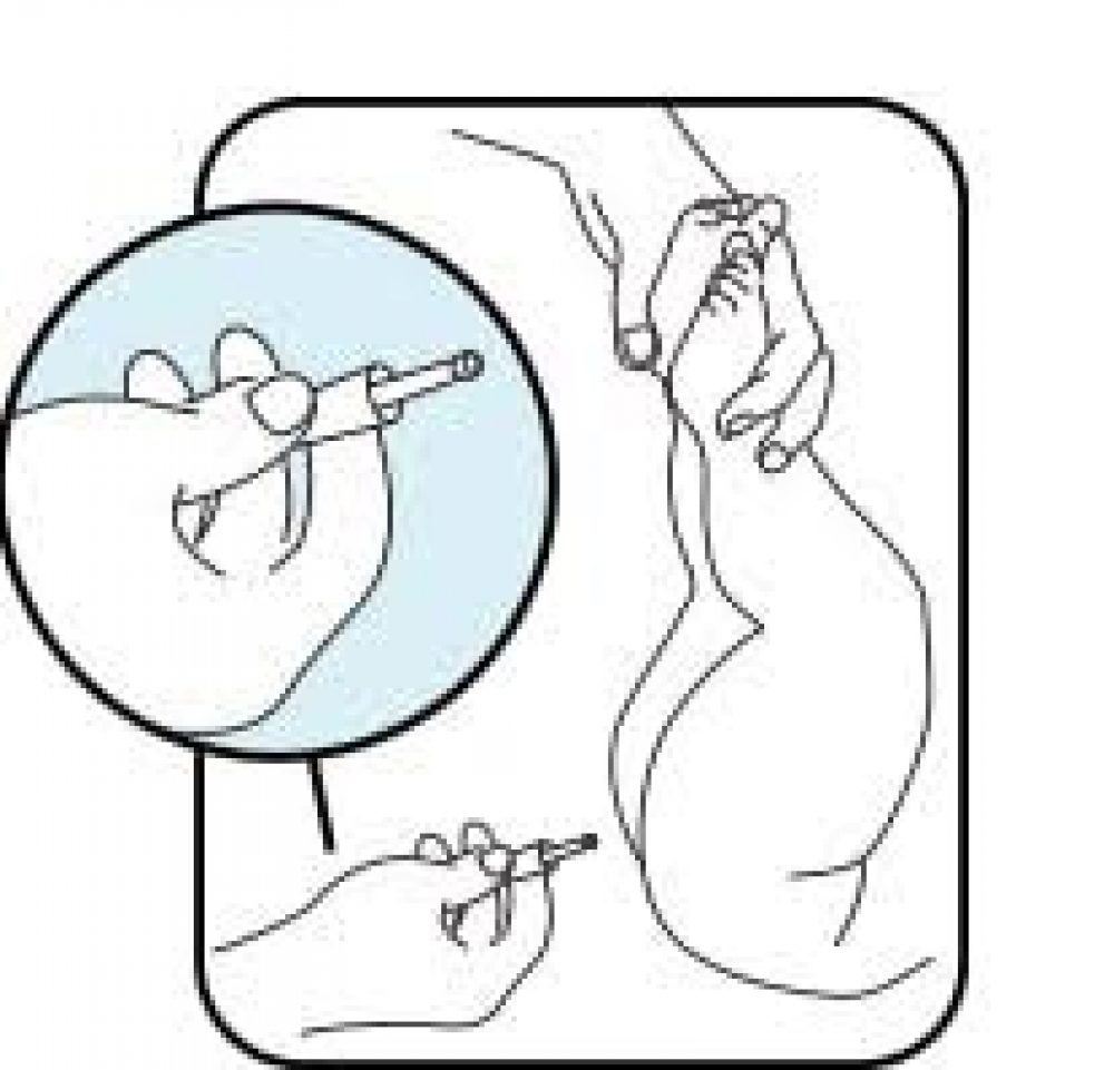 ректальный катетер для новорожденных инструкция