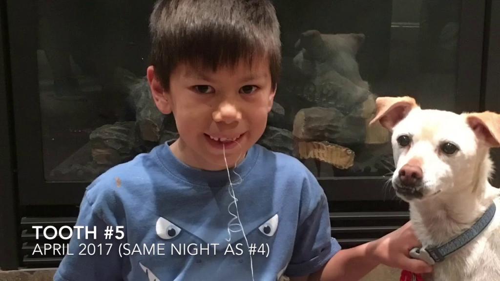 Как вырвать зуб у ребенка: самые веселые и безболезненные способы (видео)