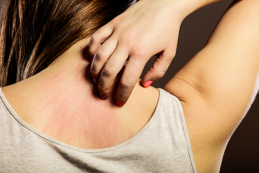 аллергия на коже груди