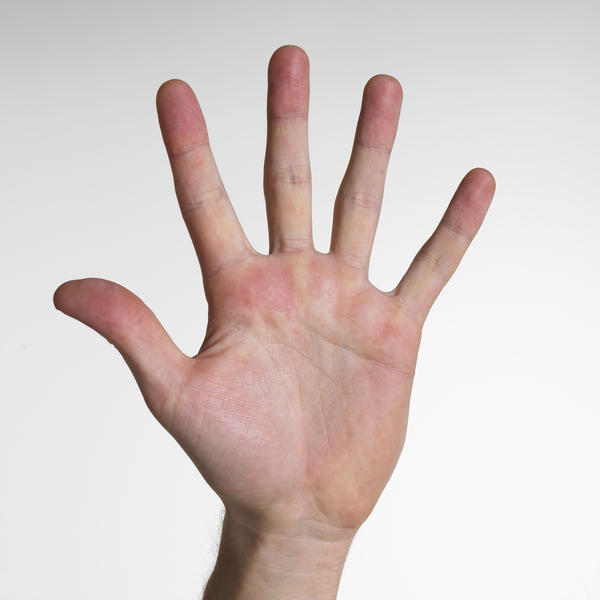 Кожа на среднем пальце правой руки thumbnail