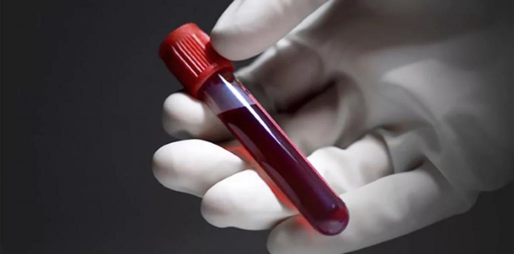 Кровь средняя концентрация гемоглобина thumbnail
