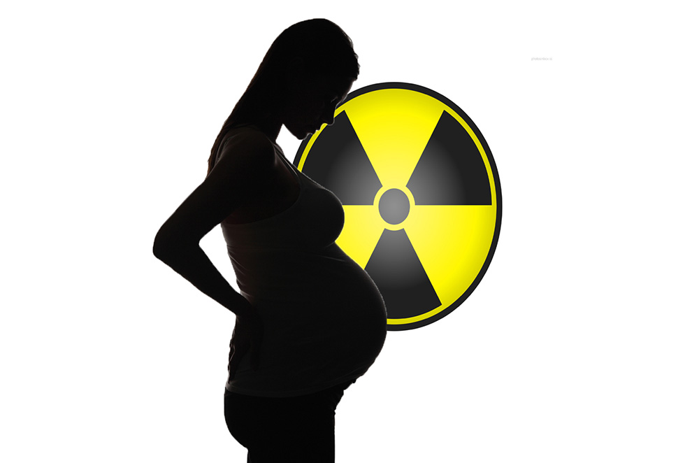 Доза облучения при рентгене - обследование беременных