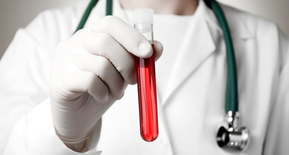 Расшифровка анализа крови на антитела к глистам thumbnail