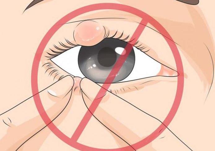От чего возникает ячмень на глазу и как его лечить