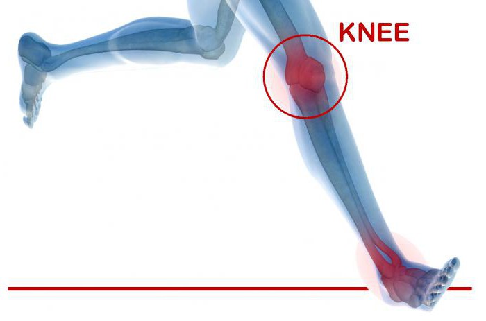Чем опасна замена коленного сустава