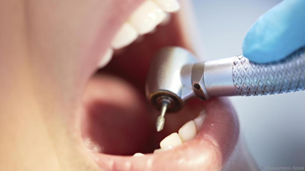 Что такое резорцин формалиновый метод лечения зубов thumbnail