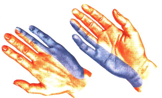 Защемление лучевого нерва руки симптомы thumbnail