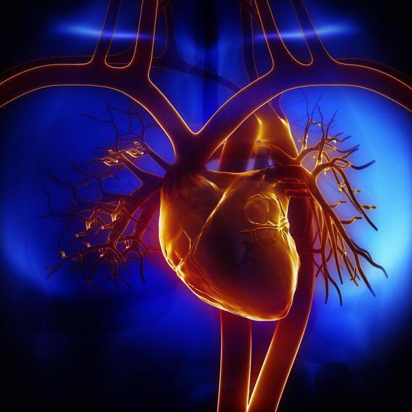 Что такое инфаркт и как он происходит
