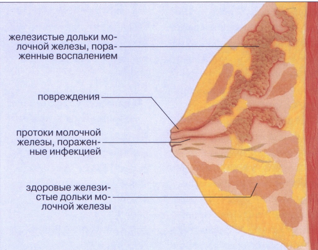 повреждения груди