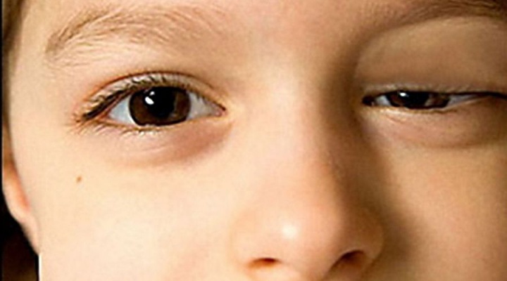 заболевания глаз у людей симптомы