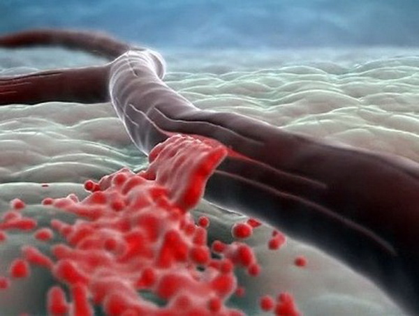 Как восстановить гемоглобин после обильных месячных thumbnail