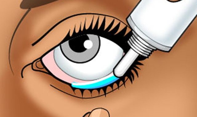 воспаление веко глаза лечение