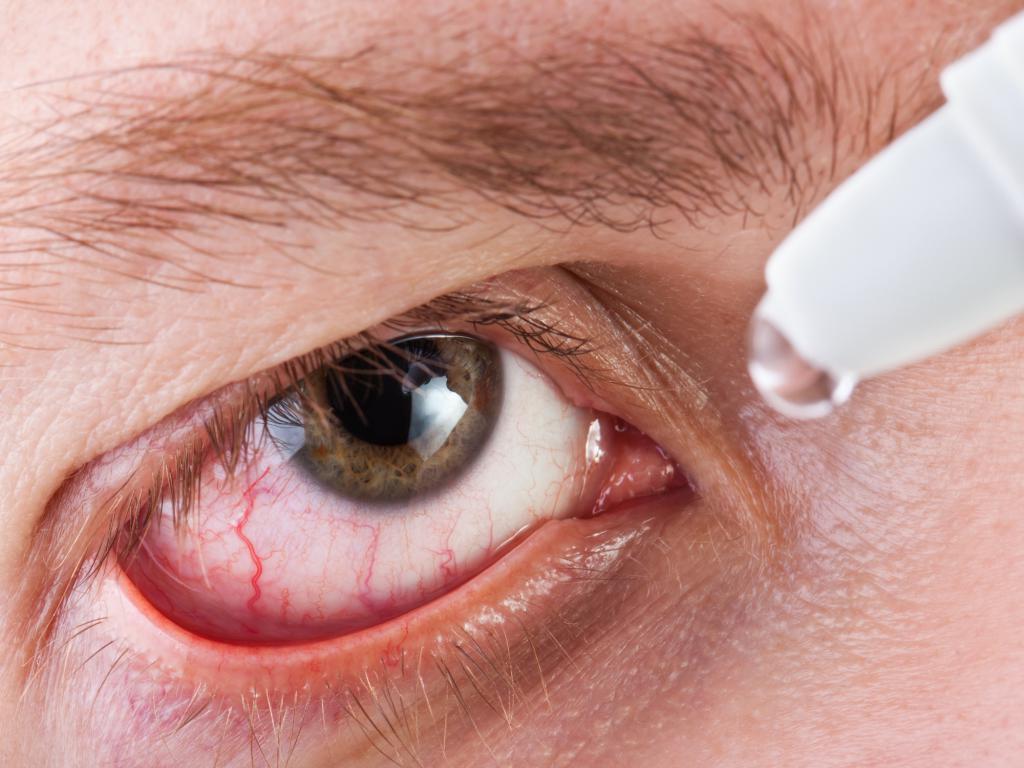 Применение лазера для лечения глаз thumbnail