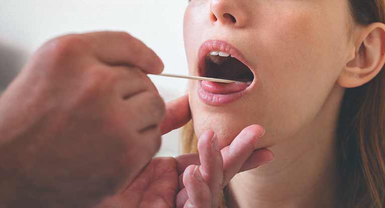 Народные средства при лечение кандидоза во рту у взрослых thumbnail