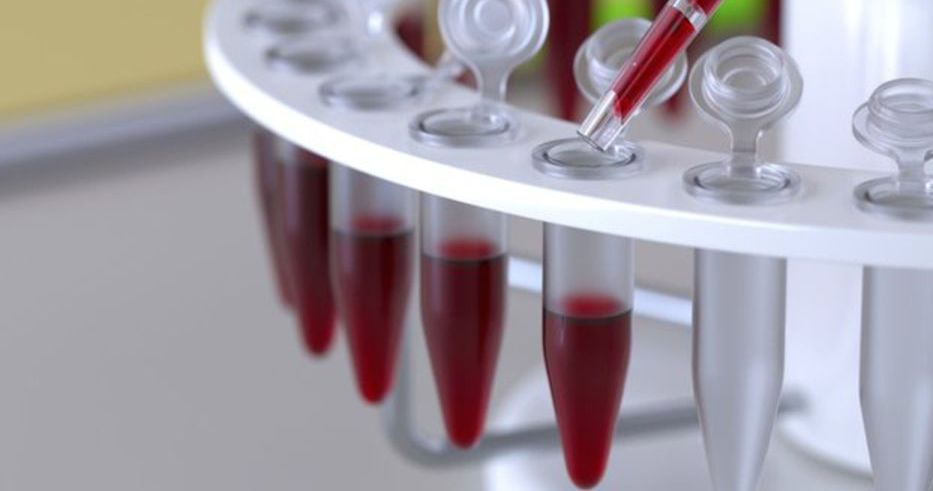 сколько делается общий анализ крови из вены