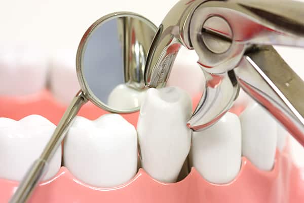 Удаление зуба при грудном вскармливании можно ли