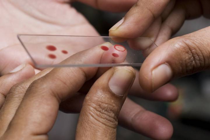 Как берется анализ крови из пальца thumbnail