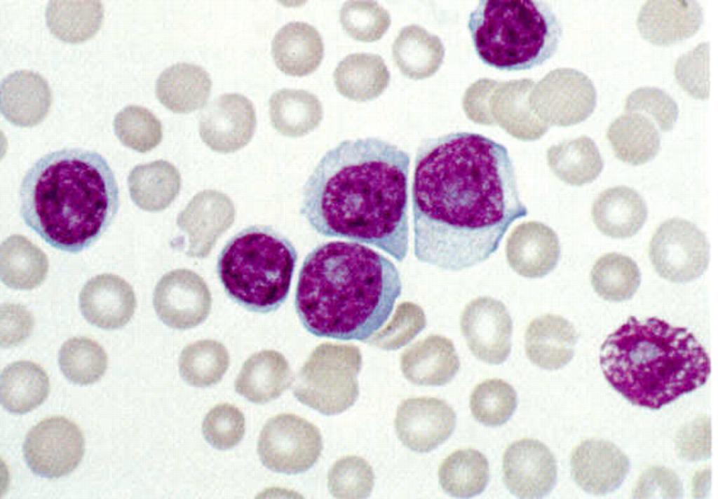 Лимфоциты cd4 в анализе крови thumbnail