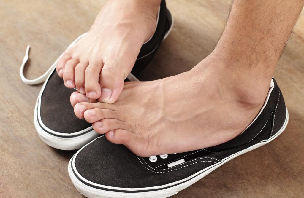 Как вылечить шипы на ногах в домашних условиях thumbnail