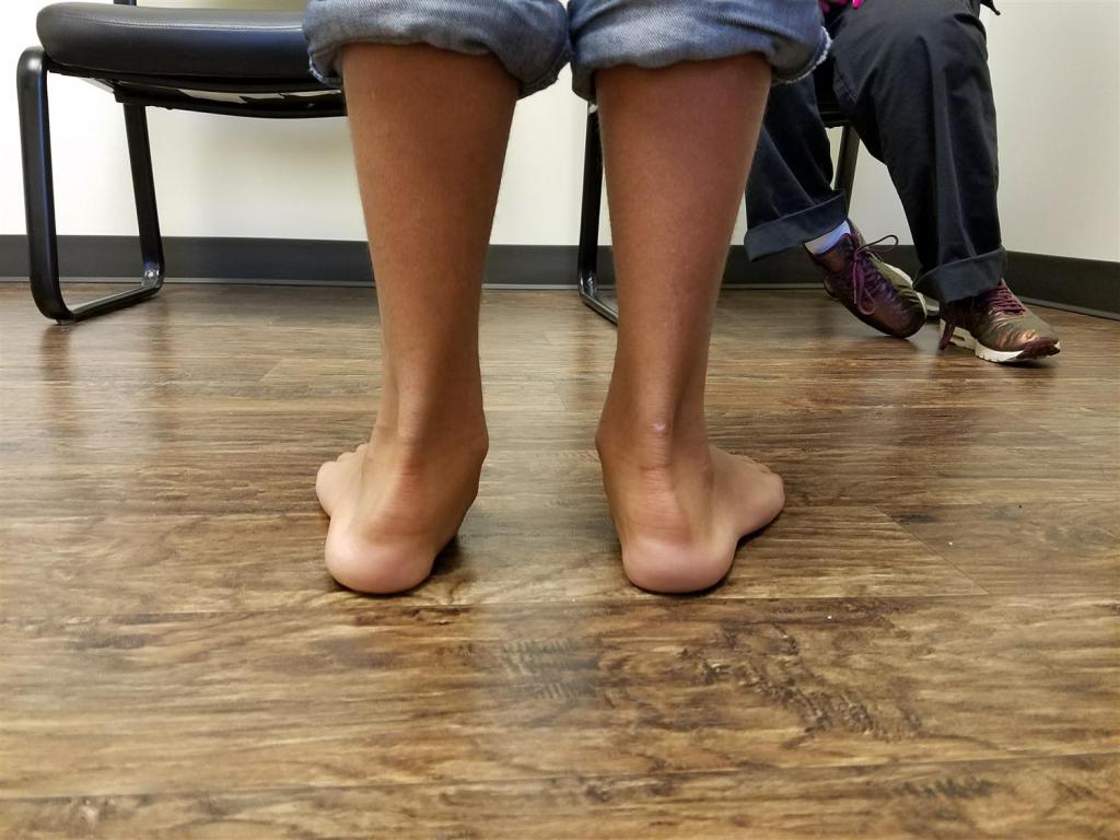 Лечение искривления ног у ребенка thumbnail