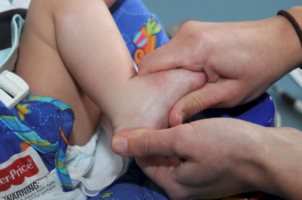 Деформация ног у ребенка 3 года thumbnail
