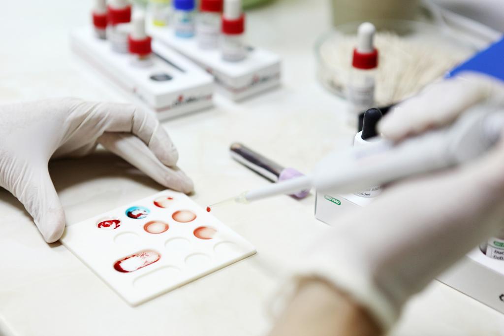 Методы лабораторной диагностики вирусных гепатитов