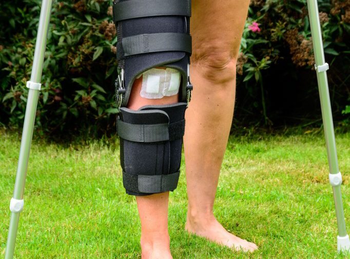 Растяжение коллатеральной связки коленного сустава лечение thumbnail