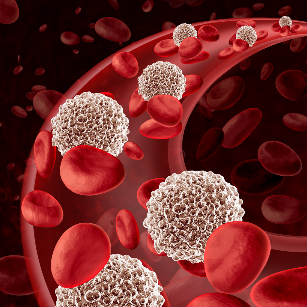 Что такое бластные клетки в анализе крови thumbnail