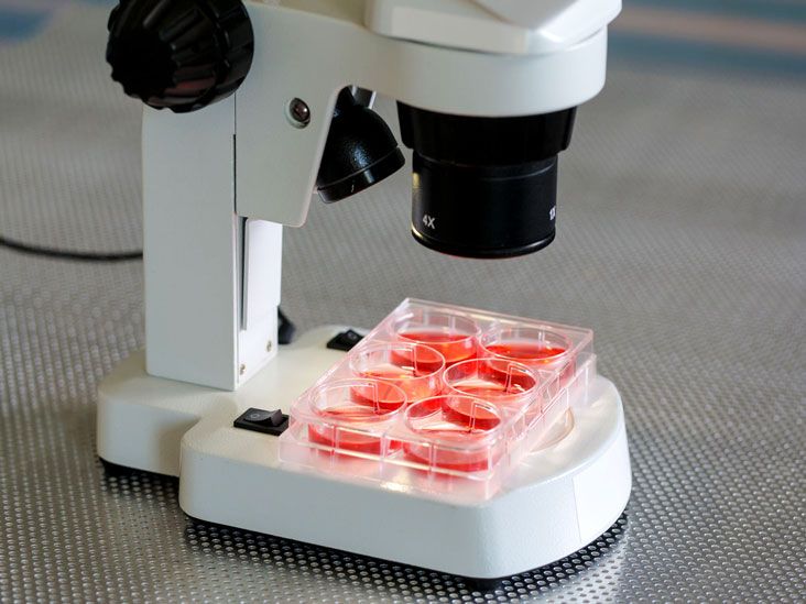 Бластные клетки как обозначаются в анализе крови что это thumbnail