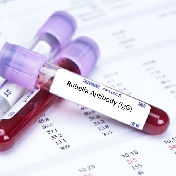 Антитела класса g к вирусу краснухи rubella virus положительный thumbnail