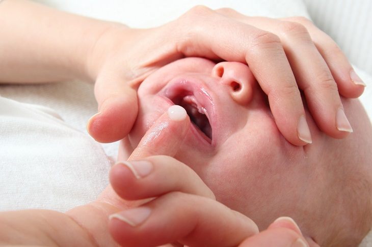 Молочница на губах у мужчин симптомы thumbnail