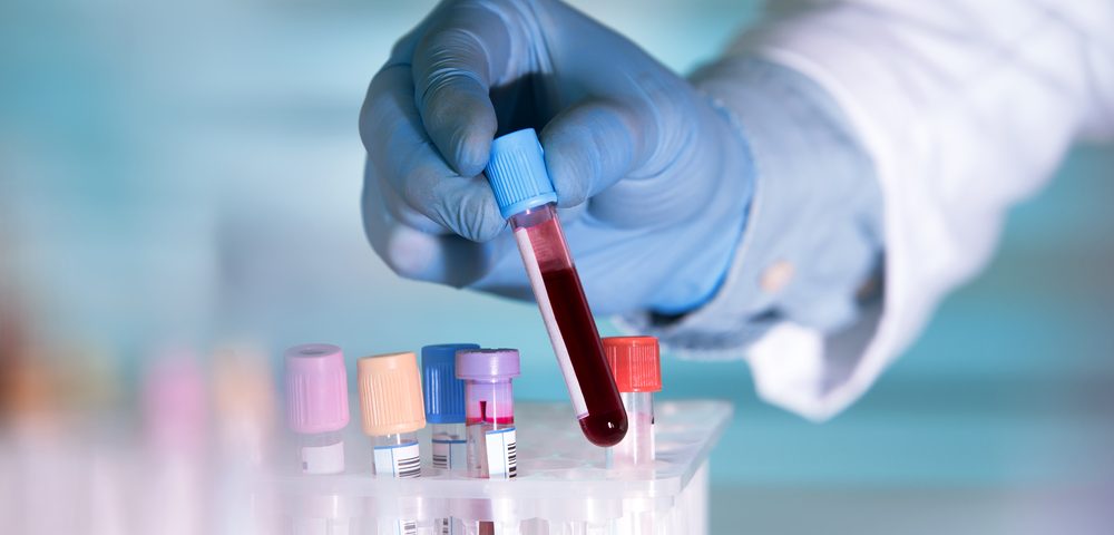лимфобластный лейкоз у детей анализ крови
