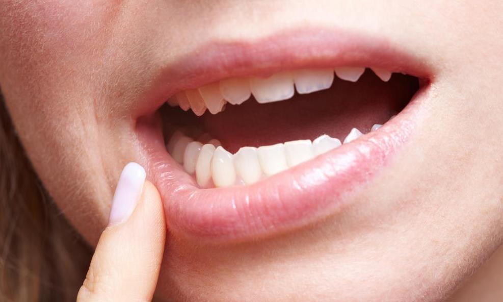 Больно открывать рот после лечения зуба мудрости thumbnail