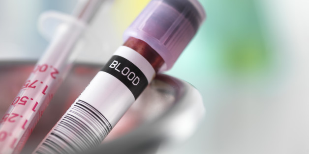 Анализ крови развернутый расшифровка у детей норма в таблице thumbnail