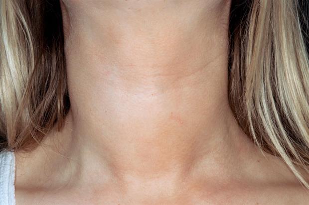 диффузные изменения щитовидной железы у женщин