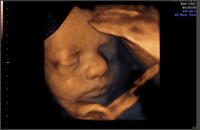 Трехмерное изображение спящего эмбриона