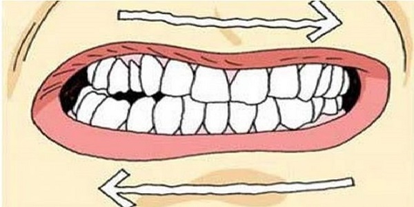 Почему зубами во сне стучат зубами thumbnail
