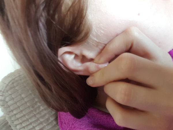 уплотнение в мочке уха прокол
