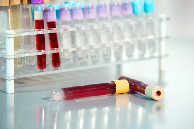 Расшифровка анализа крови содержание hb в эритроците thumbnail