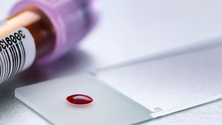 Анализ крови из вены для чего берут у ребенка thumbnail