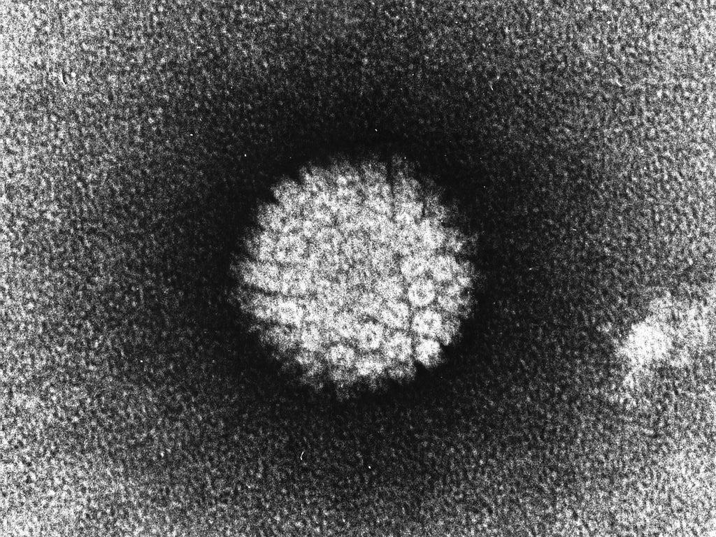 Фото вируса папилломы человека