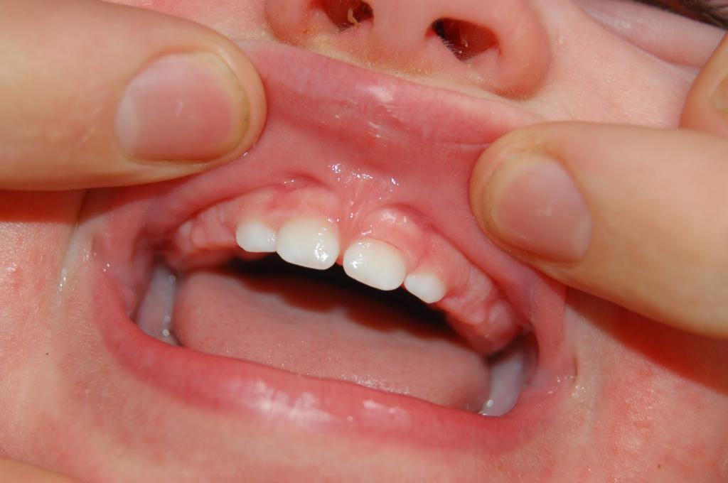 Хирургическое лечение зубов что это thumbnail