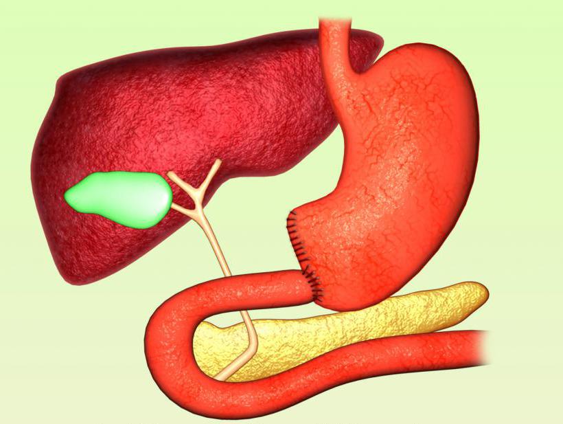 Резекция по Бильрот-1