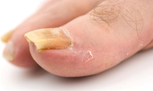 К чему снятся ногти больные на ногах thumbnail