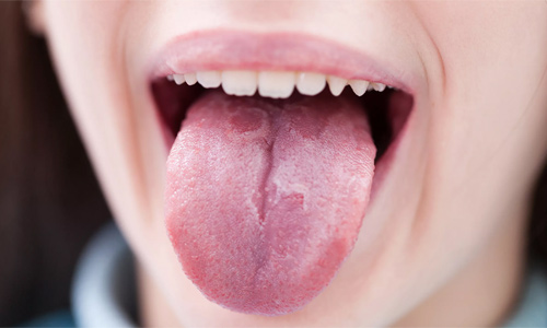 Воспаление языка какой врач thumbnail