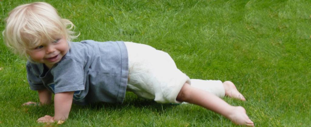 Общие принципы лечения воспаления тазобедренного сустава у детей