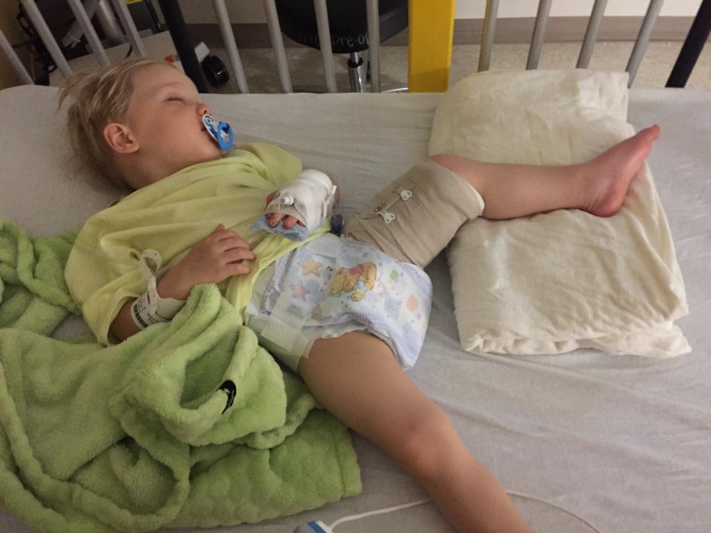 Воспаление тазобедренного сустава у ребенка 2 года thumbnail